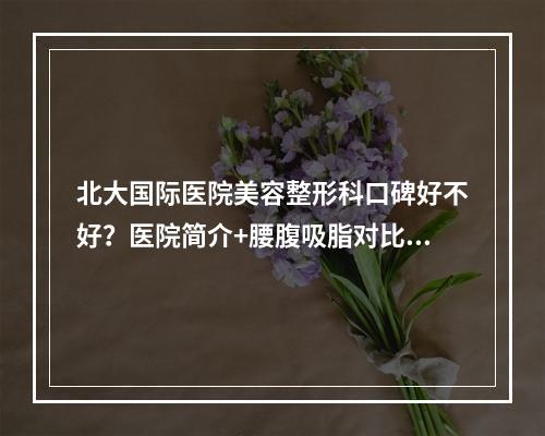 北大国际医院美容整形科口碑好不好？医院简介+腰腹吸脂对比图！