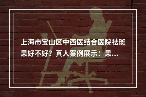 上海市宝山区中西医结合医院祛斑果好不好？真人案例展示：果真心不错！