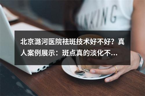 北京潞河医院祛斑技术好不好？真人案例展示：斑点真的淡化不少