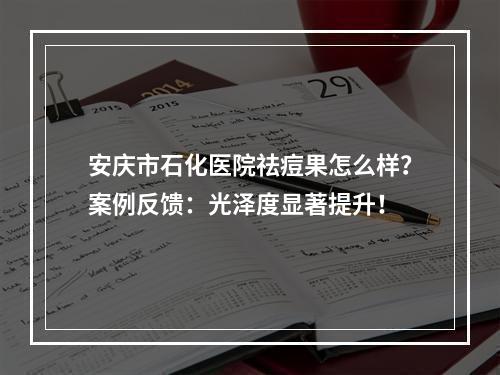 安庆市石化医院祛痘果怎么样？案例反馈：光泽度显著提升！