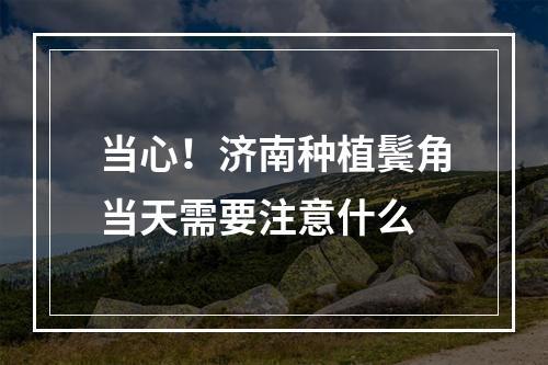 当心！济南种植鬓角当天需要注意什么