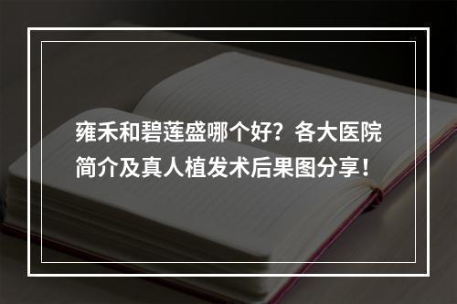 雍禾和碧莲盛哪个好？各大医院简介及真人植发术后果图分享！