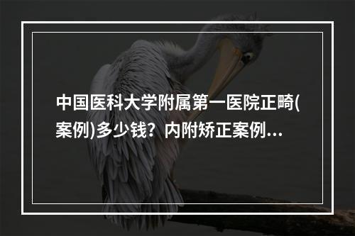 中国医科大学附属第一医院正畸(案例)多少钱？内附矫正案例以及价目表~