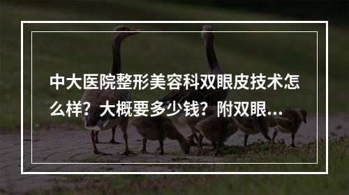 中大医院整形美容科双眼皮技术怎么样？大概要多少钱？附双眼皮案例反馈