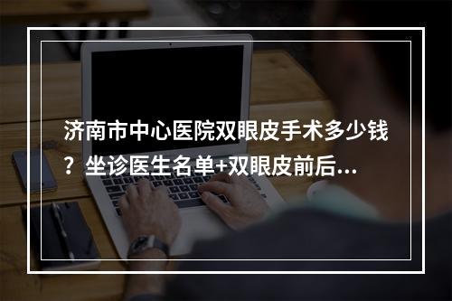 济南市中心医院双眼皮手术多少钱？坐诊医生名单+双眼皮前后对比