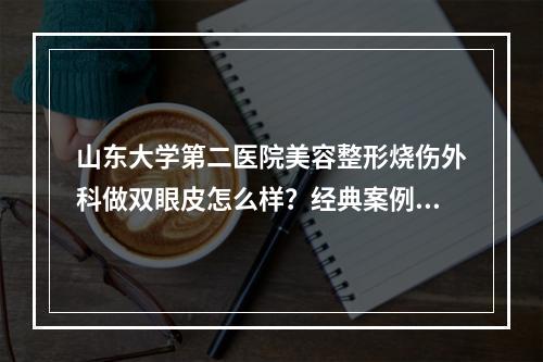 山东大学第二医院美容整形烧伤外科做双眼皮怎么样？经典案例分析|坐诊医生