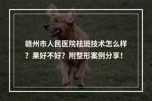 赣州市人民医院祛斑技术怎么样？果好不好？附整形案例分享！