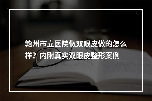 赣州市立医院做双眼皮做的怎么样？内附真实双眼皮整形案例