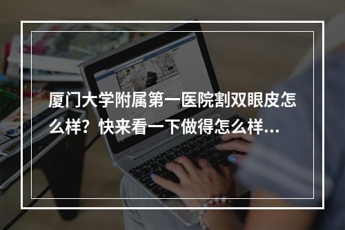 厦门大学附属第一医院割双眼皮怎么样？快来看一下做得怎么样吧！