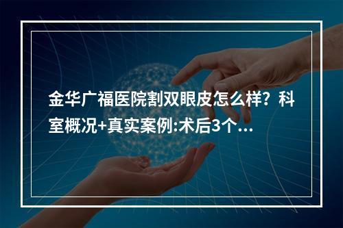 金华广福医院割双眼皮怎么样？科室概况+真实案例:术后3个月很有