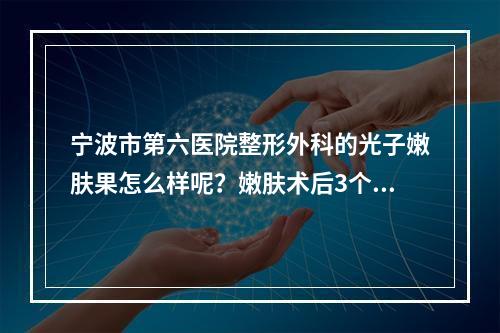 宁波市第六医院整形外科的光子嫩肤果怎么样呢？嫩肤术后3个月反馈