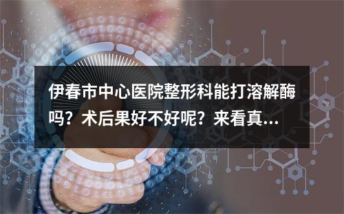 伊春市中心医院整形科能打溶解酶吗？术后果好不好呢？来看真实案例分享吧！