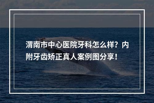 渭南市中心医院牙科怎么样？内附牙齿矫正真人案例图分享！