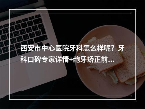 西安市中心医院牙科怎么样呢？牙科口碑专家详情+龅牙矫正前后对比