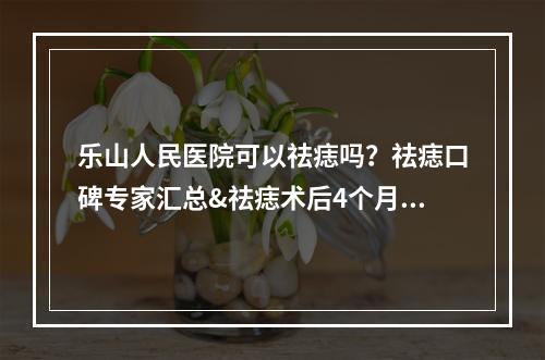 乐山人民医院可以祛痣吗？祛痣口碑专家汇总&祛痣术后4个月果！