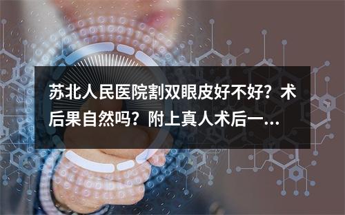 苏北人民医院割双眼皮好不好？术后果自然吗？附上真人术后一个月恢复图