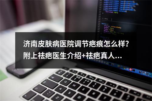 济南皮肤病医院调节疤痕怎么样？附上祛疤医生介绍+祛疤真人案例图