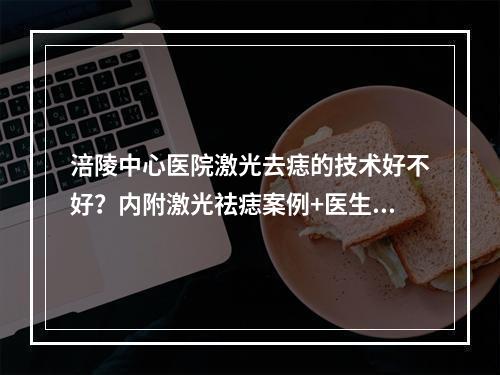 涪陵中心医院激光去痣的技术好不好？内附激光祛痣案例+医生名单