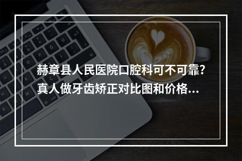 赫章县人民医院口腔科可不可靠？真人做牙齿矫正对比图和价格表奉上