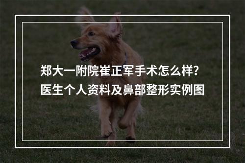 郑大一附院崔正军手术怎么样？医生个人资料及鼻部整形实例图