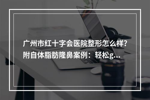 广州市红十字会医院整形怎么样？附自体脂肪隆鼻案例：轻松get挺拔鼻梁~