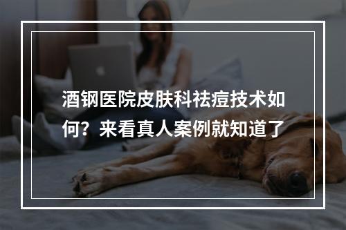 酒钢医院皮肤科祛痘技术如何？来看真人案例就知道了