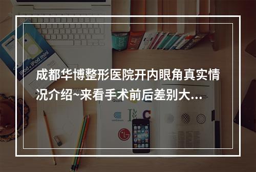 成都华博整形医院开内眼角真实情况介绍~来看手术前后差别大吗