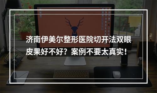 济南伊美尔整形医院切开法双眼皮果好不好？案例不要太真实！