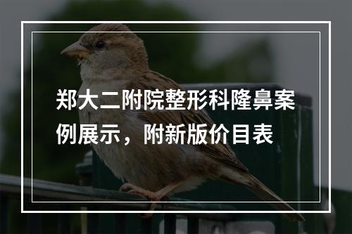 郑大二附院整形科隆鼻案例展示，附新版价目表