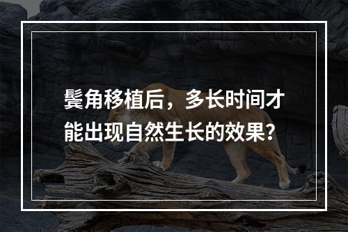 鬓角移植后，多长时间才能出现自然生长的效果？