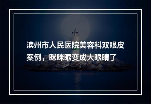 滨州市人民医院美容科双眼皮案例，眯眯眼变成大眼睛了