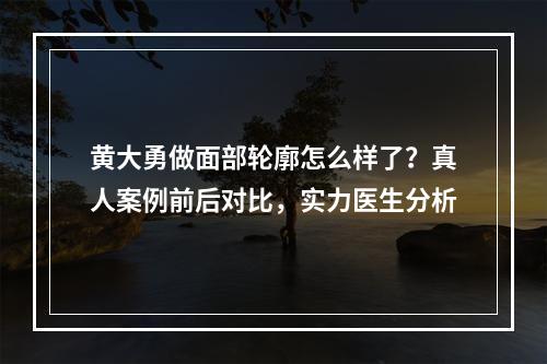 黄大勇做面部轮廓怎么样了？真人案例前后对比，实力医生分析