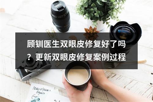 顾钏医生双眼皮修复好了吗？更新双眼皮修复案例过程