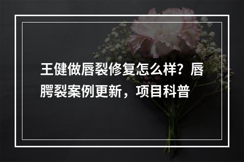 王健做唇裂修复怎么样？唇腭裂案例更新，项目科普