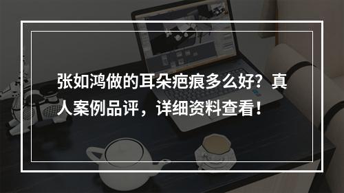 张如鸿做的耳朵疤痕多么好？真人案例品评，详细资料查看！