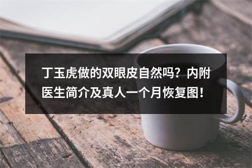 丁玉虎做的双眼皮自然吗？内附医生简介及真人一个月恢复图！