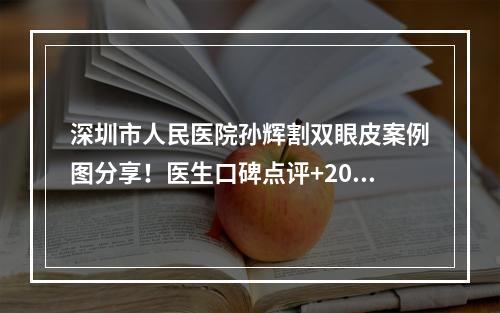 深圳市人民医院孙辉割双眼皮案例图分享！医生口碑点评+2022价格表一览！