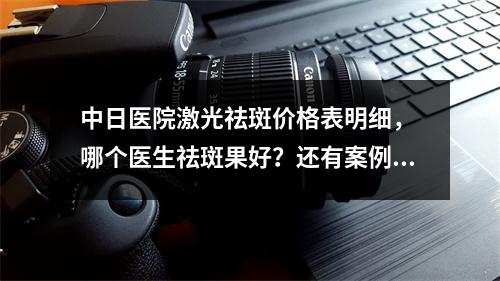 中日医院激光祛斑价格表明细， 哪个医生祛斑果好？还有案例对比