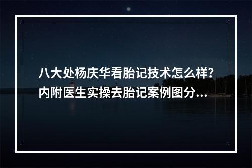 八大处杨庆华看胎记技术怎么样？内附医生实操去胎记案例图分享！