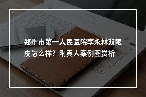 郑州市第一人民医院李永林双眼皮怎么样？附真人案例图赏析