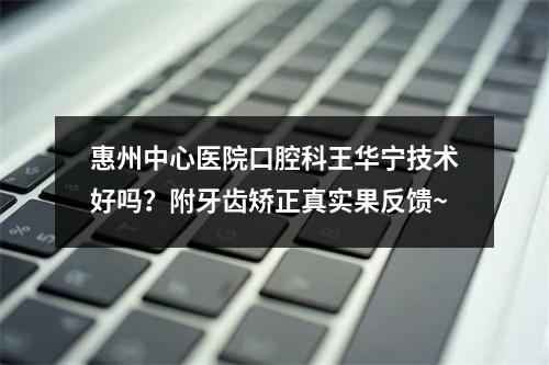 惠州中心医院口腔科王华宁技术好吗？附牙齿矫正真实果反馈~