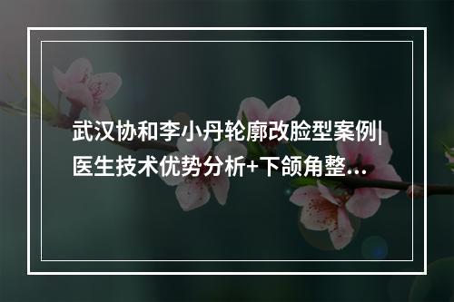 武汉协和李小丹轮廓改脸型案例|医生技术优势分析+下颌角整形价格表