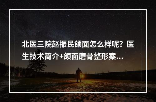 北医三院赵振民颌面怎么样呢？医生技术简介+颌面磨骨整形案例