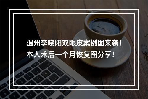 温州李晓阳双眼皮案例图来袭！本人术后一个月恢复图分享！