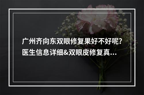 广州齐向东双眼修复果好不好呢？医生信息详细&双眼皮修复真实果参考