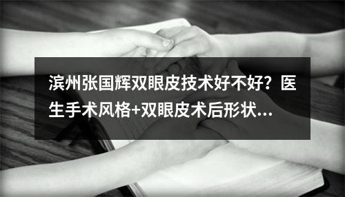 滨州张国辉双眼皮技术好不好？医生手术风格+双眼皮术后形状果反馈