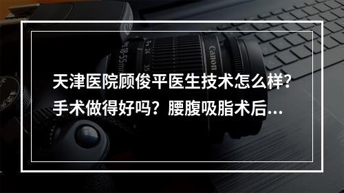 天津医院顾俊平医生技术怎么样？手术做得好吗？腰腹吸脂术后恢复反馈