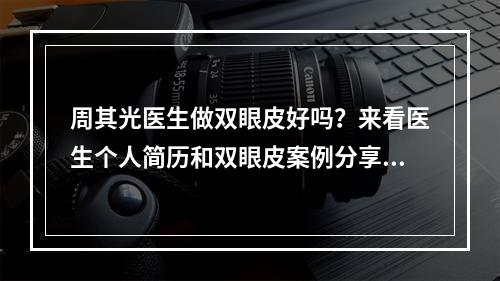 周其光医生做双眼皮好吗？来看医生个人简历和双眼皮案例分享！