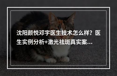 沈阳颜悦邓宇医生技术怎么样？医生实例分析+激光祛斑真实案例