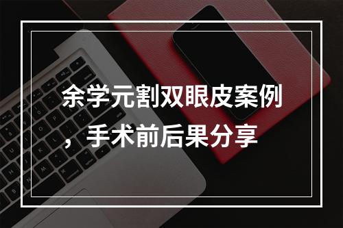 余学元割双眼皮案例，手术前后果分享